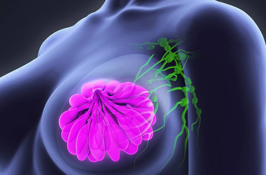 Inteligencia artificial sería clave para identificar el cáncer de mama a futuro, según estudio