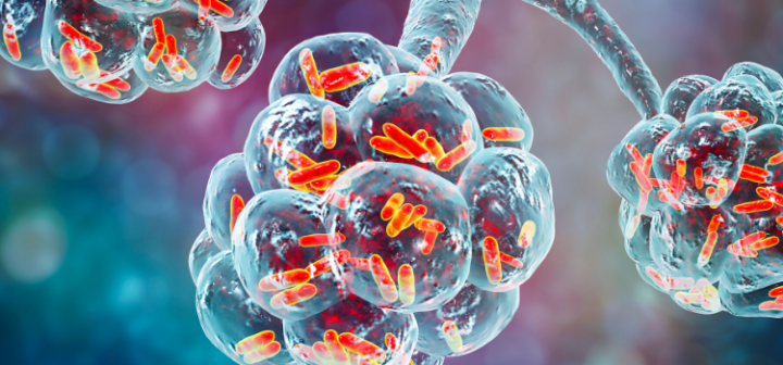  Mycoplasma pneumoniae: un desafío para la salud pública